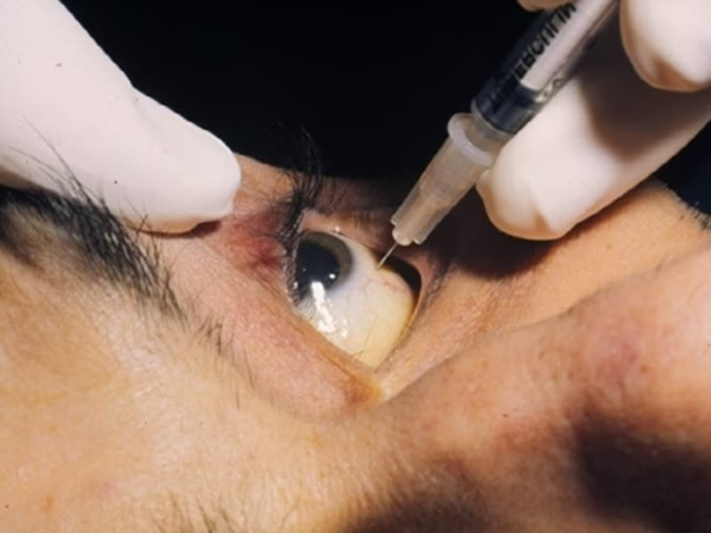 nih_141003_intravitreal_injection_800x600