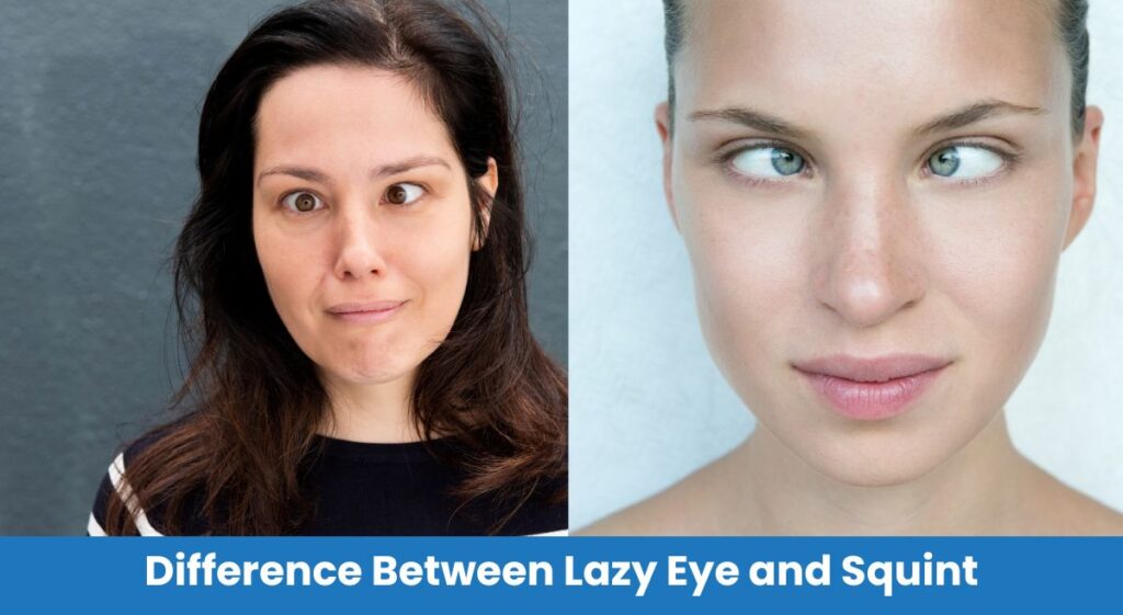 difference between lazy eye and squint