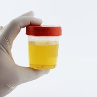 Urine Test